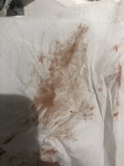 Am I having a chemical pregnancy? TMI but pic included 