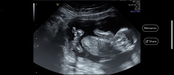 Due December 2022 thread 3