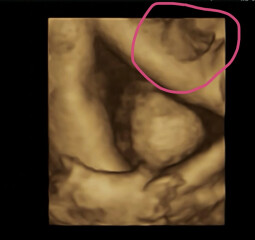 Does this look like a boy? 