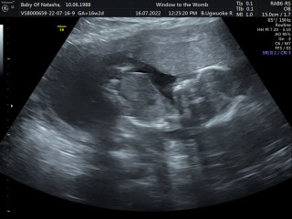 Due December 2022 (thread 4)