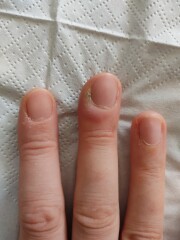 What's wrong with my finger? (photos)