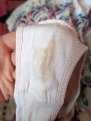 Is this discharge colour normal? (Photo included)