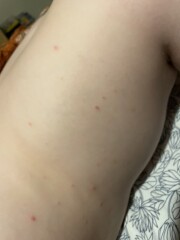 What are these spots?