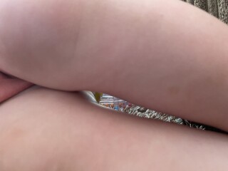 Worried about Café au lait marks?