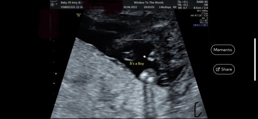 Due December 2022 thread 3