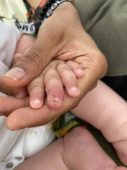 Sick with worry- baby's finger
