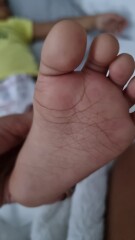 Does this look like Hand Foot & Mouth?