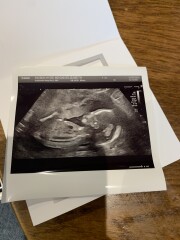 Boy or Girl?! What do you all think? 