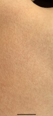 Rash (with pics)