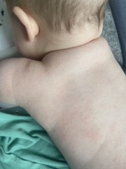Very dry skin?