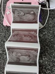 13 weeks scan, guess gender?