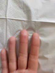 What's wrong with my finger? (photos)