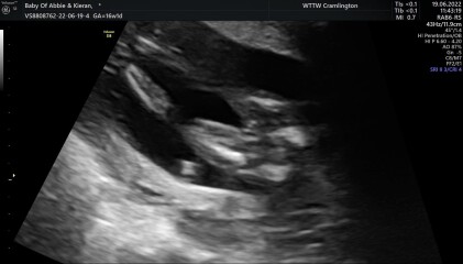Is this definitely a girl?