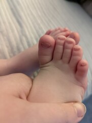 Spoon shaped nails