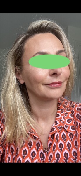 Hair colour help