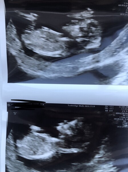 Boy or girl?