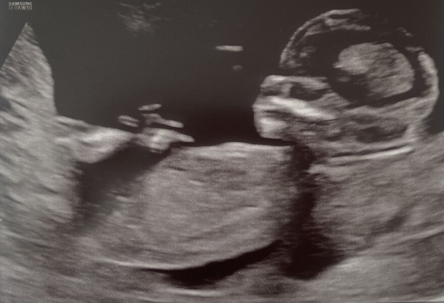 Curious to know sex of baby 