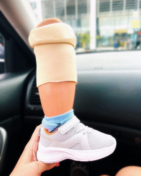 My toddler had his leg amputated