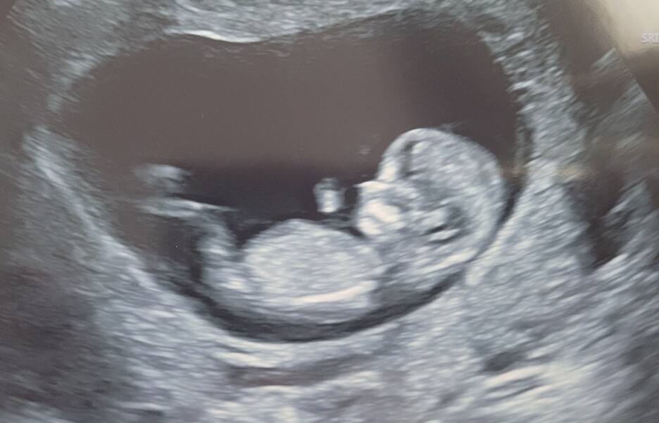 Due Feb/Mar after MC 🌈 🙈