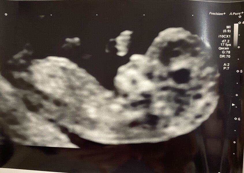 Gender guesses? 