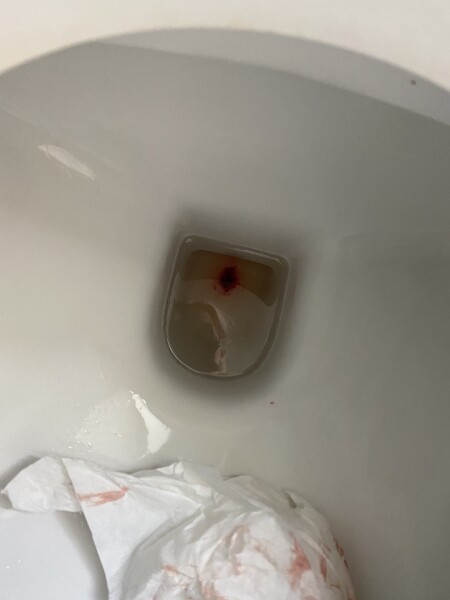 Is this a miscarriage! Sensitive picture below!!!!! 