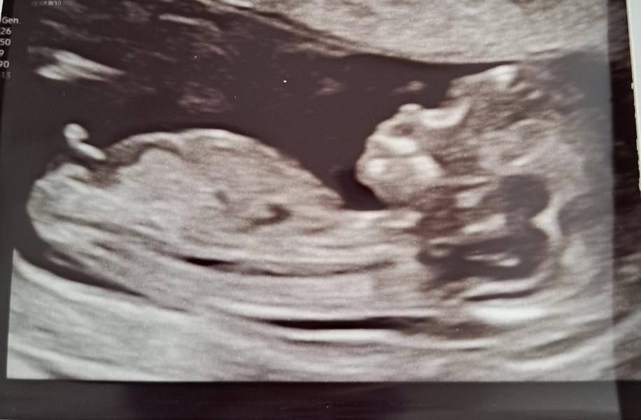 Due March 2023 - thread 2 