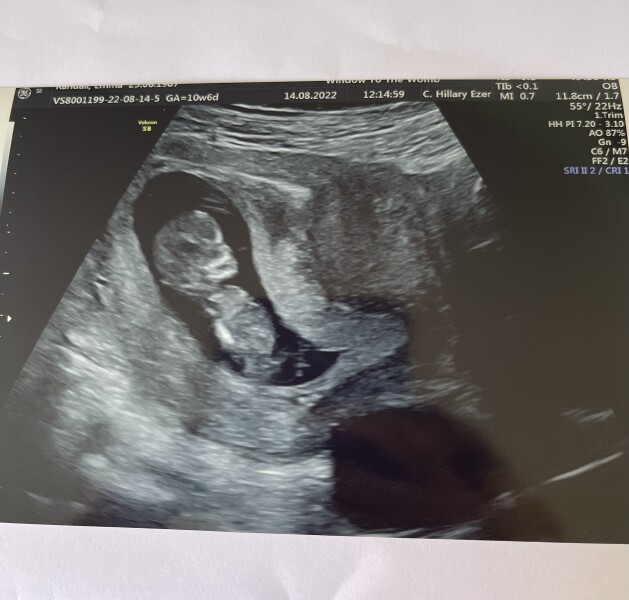 IVFers Due Mar & Apr 2023
