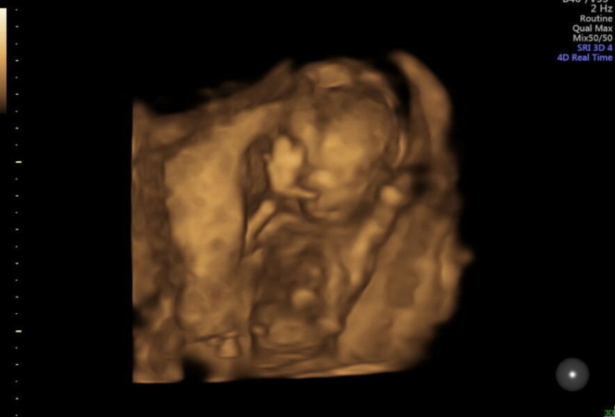 37 years old and possibly pregnant! Need advice