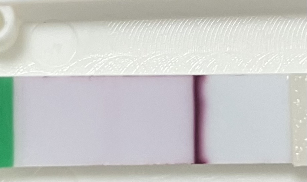 Tired eyes - is there a faint line? 
