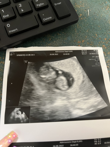 Due March 2023 - thread 2 