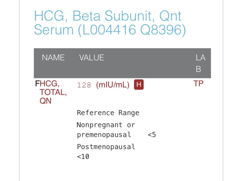 HCG LEVEL too low or no?