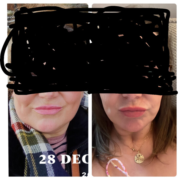 I've lost 2.5 stone. Can't work out if it looks like I have! Pic attached