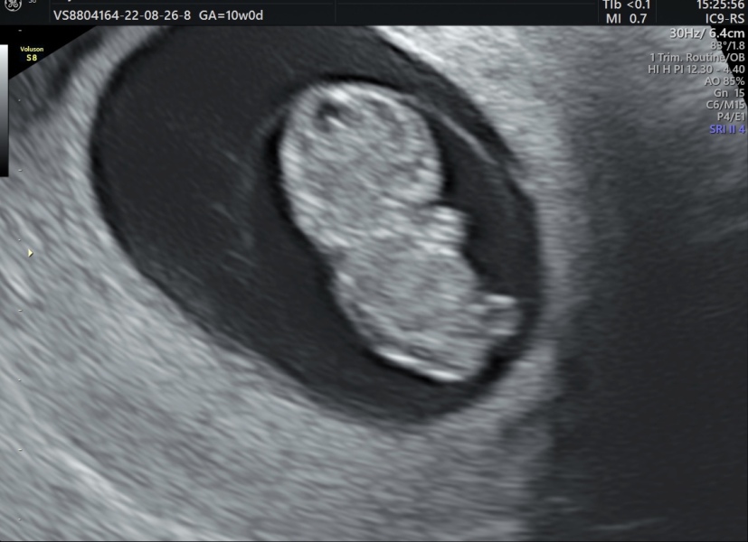 Due March 2023 - thread 2 
