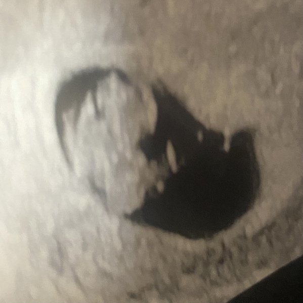 Babies due April 2023 thread 3