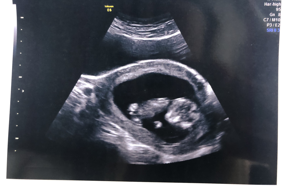 Due February 2023 ❤️💙💛💖 Thread 2!