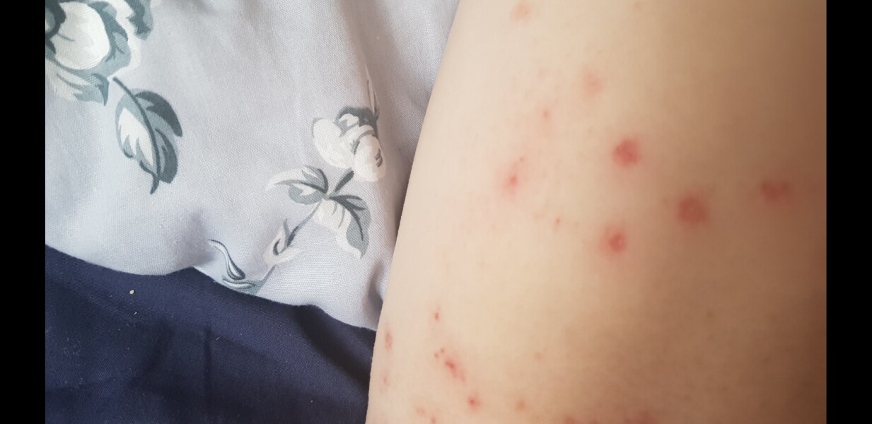 What are these spots - bed bugs?