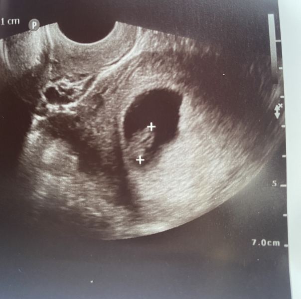 Babies due April 2023 thread 3