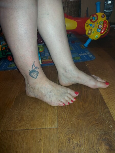 Do I need to worry about swollen ankle? Varicose viens? *picture attached* 