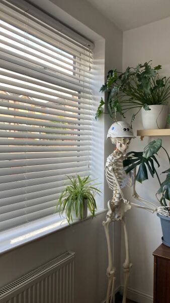 Help with window dressing please!!! 