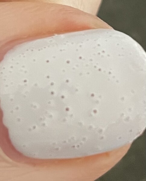 Porous nails? 