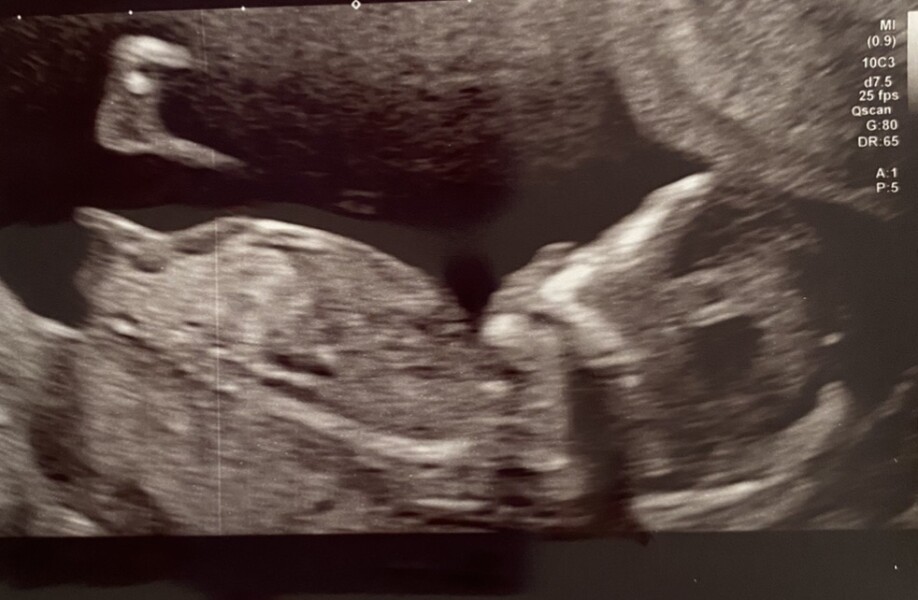 Nub theory prediction wrong?