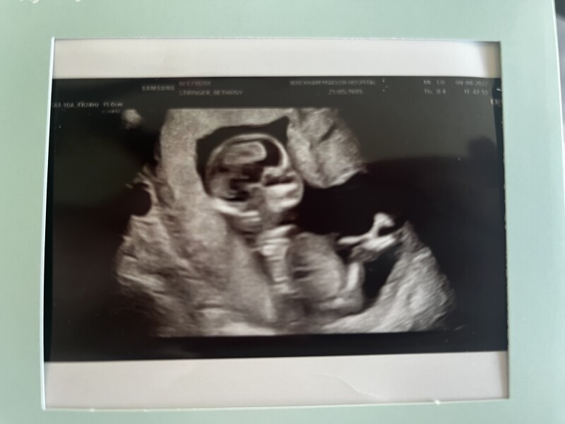 13 weeks + 4 boy or girl?