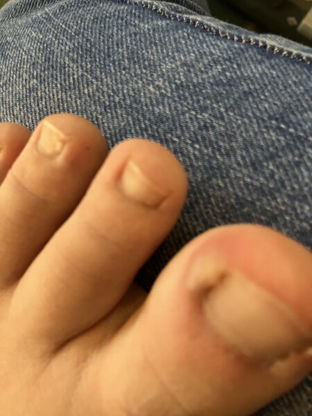 Dd toe. Is this infected?
