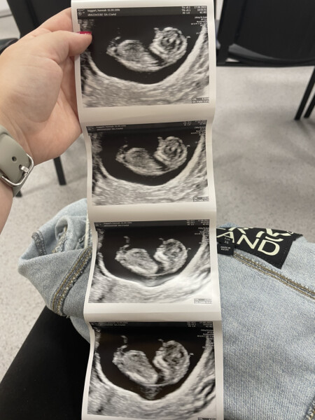 Due March 2023 - thread 2 