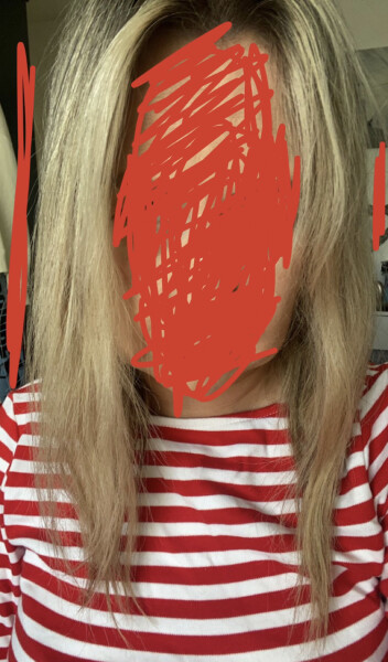 What's wrong with my hair? Breaking off (pics included )