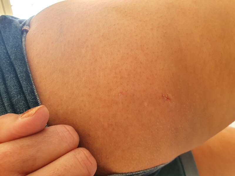 Stranger's dog bit me - what should I have done? 