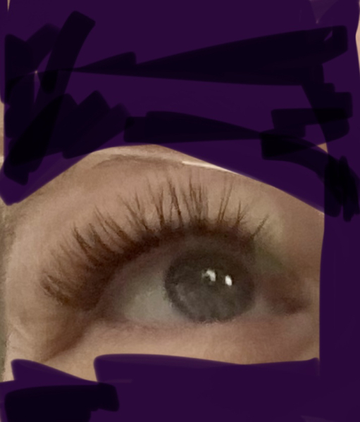 To think of this as an investment in my health as well as cosmetic treatment?