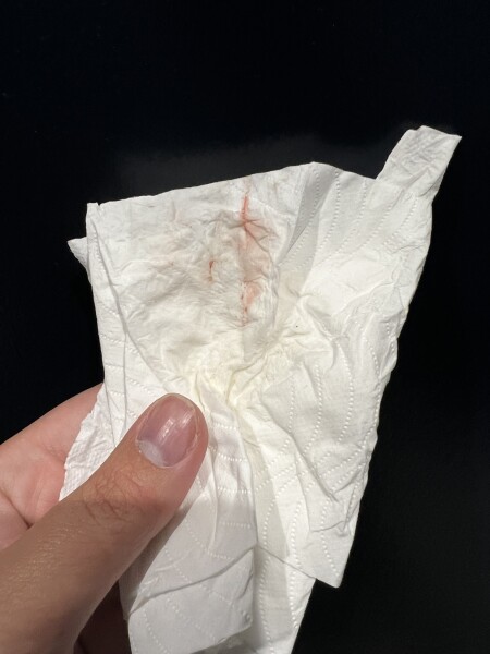 Early pregnancy bleed 