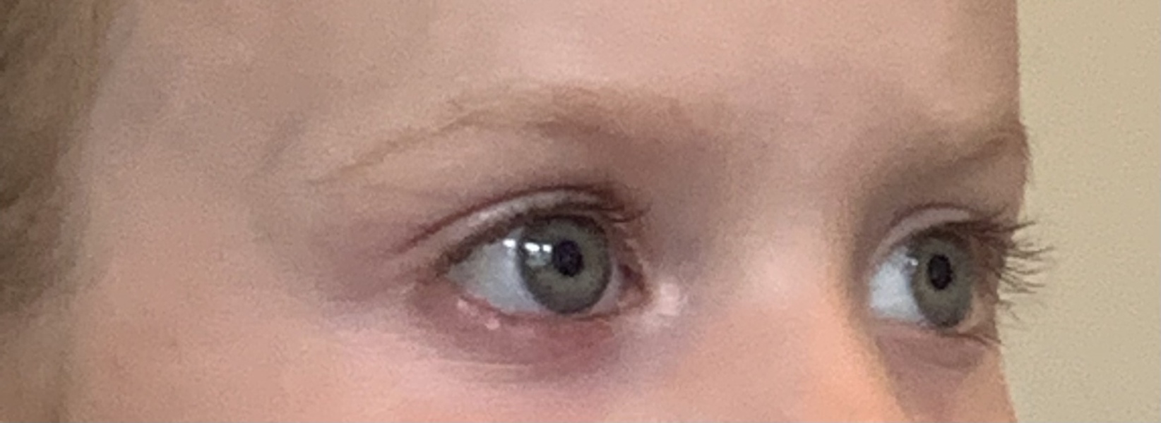 DD’s eye - help please! 