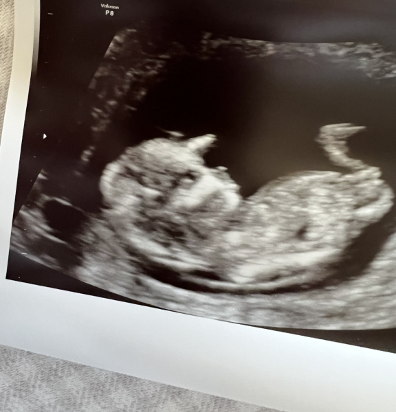 Due March 2023 - thread 2 
